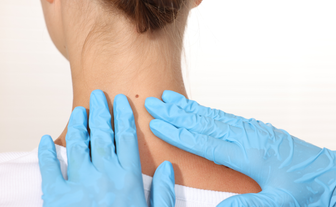 Haut regelmäßig kontrollieren