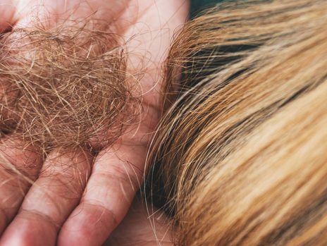 Haarausfall bei Frauen