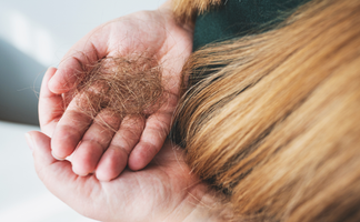 Haarausfall bei Frauen